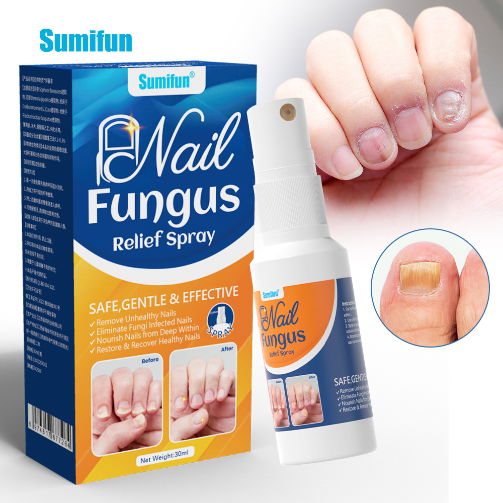 Sumifun Gentle Renewal Spray - for Dull Skin Texture, Conditioning Formula to Support a Healthy Glow