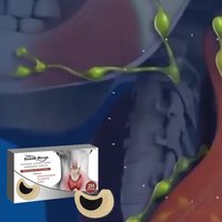 Patch naturel de drainage des ganglions thyroïdiens, 20 autocollants à base de plantes pour le soulagement des gonflements du cou et les soins lymphatiques