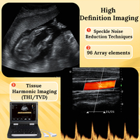 Appareil d'échographie Doppler couleur portable OEM RS CU5 pour les cliniques d'imagerie médicale, les hôpitaux et les centres de diagnostic