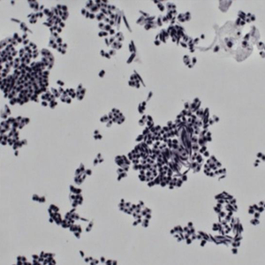 BestScope BS-3060FB système optique à Zoom parallèle infini <span class=keywords><strong>Microscope</strong></span> stéréo Fluorescent - Product Image 3