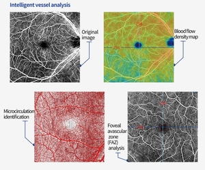 Quang học kết hợp chụp Cắt Lớp velite c808b Oct chụp động mạch Thiết bị đo thị lực thông minh dụng cụ Nhãn KhoA - Product Image 3