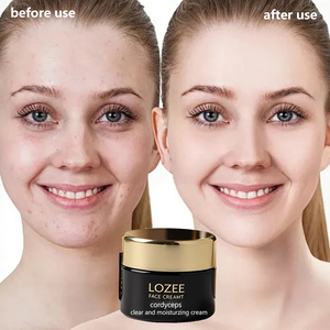 Crème éclaircissante anti-taches LOZEE, atténue le chloasma, les taches solaires, les taches de vieillesse, éclaircit le teint, hydrate, répare la peau - Product Image 5