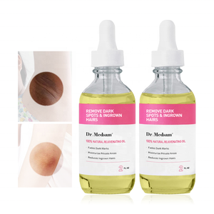 PH Cân Bằng Yoni Dầu Nữ Tính Chăm Sóc Cơ Thể Làm Trắng Giảm Mọc Trong Lông Và Đốm Đen - Product Image 6