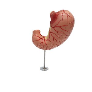 VIC-D021B Modelo de Estómago Natural Grande de 2 Componentes: Modelo de Enseñanza de Úlcera Gástrica Humana, Modelo de Enseñanza Patológica - Product Image 5