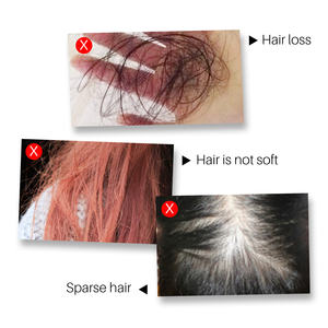 Natural Nourish Follicle Anti-<b>Hair</b> Loss Silicone-Free <b>Hair</b> <b>Growth</b> <b>Spray</b> 30ml Suitable for Thinning <b>Hair</b> - Product Image 6