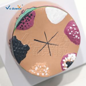 बच्चों के लिए त्वचा कैंसर शारीरिक शिक्षा मॉडल मैनिकिन प्लास्टिक/पीसी - Product Image 5