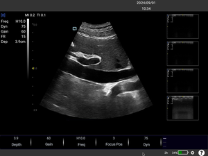 Diagnosis umum mesin <span class=keywords><strong>Ultrasound</strong></span> portabel, pemindai <span class=keywords><strong>Ultrasound</strong></span> Laptop <span class=keywords><strong>15</strong></span> inci DICOM dan PW fungsional B51 - Product Image 2