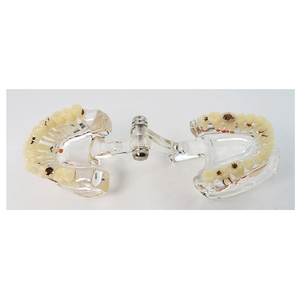 Modelo de Patología Dental con Dientes de Implante Parcial para Enseñanza - Product Image 6