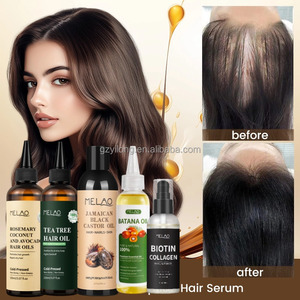 Prodotti per la cura dei capelli con etichetta privata rosmarino di cocco e oli di Avocado riparazione dei capelli oliatura cuoio capelluto massaggio olio di rosmarino per la crescita dei capelli - Product Image 6