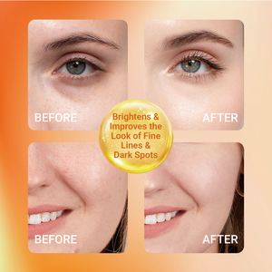 Sérum à la vitamine C pour le visage, formule anti-âge, sérum éclaircissant, améliore l'apparence des taches brunes, des ridules et des rides - Product Image 5