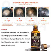 Meilleure huile de croissance des cheveux pour la calvitie Réparation du cuir chevelu Huile capillaire Anti perte de cheveux