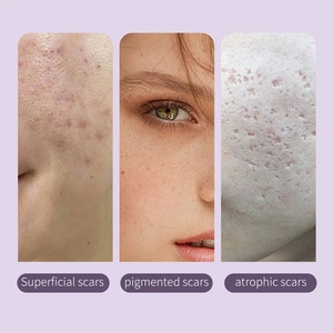 เอสเซนส์บำรุงผิวหน้า AESTHTANY Blemish Smoothing Serum 30 มล. ผสมสารสกัดซิลิโคนและใบ<span class=keywords><strong>บัวบก</strong></span> ช่วยล็อคความชุ่มชื้น ปรับสภาพผิวหยาบกร้าน บำรุงผิวหน้า - Product Image 4