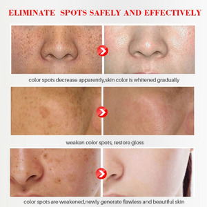 Creme Clareador de Manchas IBeaLee Remove <span class=keywords><strong>Melasma</strong></span> e Manchas Escuras Clareia a Melanina Hidratante Iluminador para Cuidados com a Pele do Rosto 20ml - Product Image 2
