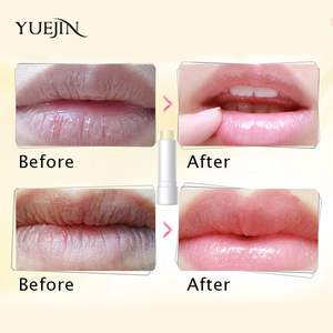 Etiqueta privada OEM Venta al por mayor Labios de bebé Bálsamo labial Hidratante Aclarador Aceite de coco mágico Bálsamo labial para terapia - Product Image 4