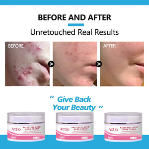 Mới đến các loại kem chống lại mụn trứng cá cho khuôn mặt mụn trứng cá mục tiêu nhược điểm làm giảm đỏ calms xóa - Product Image 5