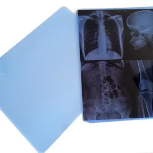 Mavi resim x-ray mürekkep püskürtmeli film mavi renk a4 boyutu