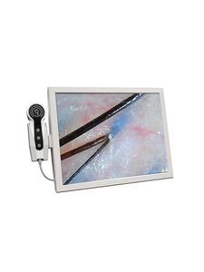 Instrumento para el Cuidado del Cuero Cabelludo, Detección Capilar, Terapia Eléctrica Anticaída, Peine para el Cuidado del Cabello, Dispositivo de Terapia para el Crecimiento del Cabello - Product Image 5