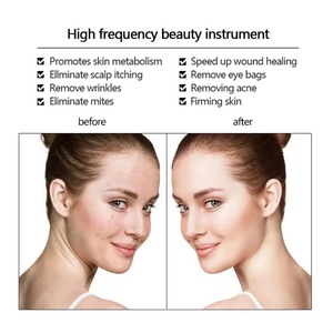 Appareil de thérapie cutanée portable professionnel à haute fréquence, traitement de l'acné, lifting du visage, ciblé pour les soins de la peau du visage - Product Image 4