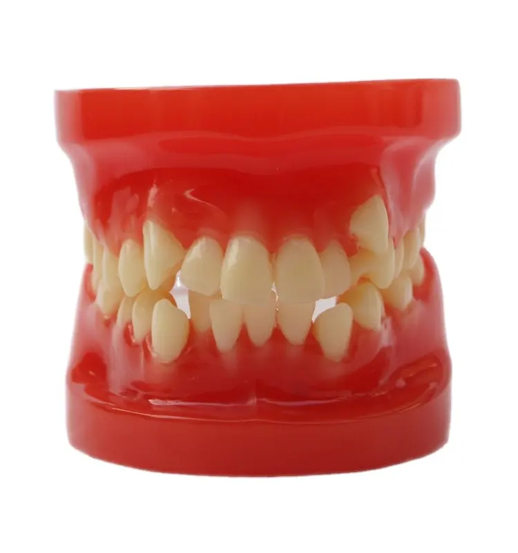 Diş ortodonti modeli öğretim İmplant restorasyon diş modeli hizalama ekran