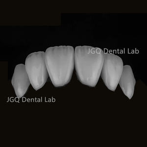 الأسنان إيماكس زركونيا تبييض الأسنان إيماكس وزركونيا القشرة مختبر الأسنان رخيصة الثمن - Product Image 2