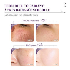 韓国アンチエイジングスキンケアオイルニコチンアミドヒアルロン酸抗しわホワイトニングモイスチャライザーフェイスホーム用リペアスキン - Product Image 3