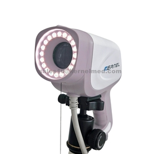 Kn2200i HD video kỹ thuật số <span class=keywords><strong>colposcope</strong></span> với <span class=keywords><strong>CE</strong></span> Mark cho âm đạo cổ tử cung phụ khoa kiểm tra - Product Image 4