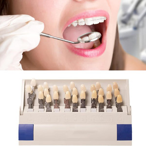 SJ Chuyên Nghiệp Răng Nha Khoa Làm Trắng Bóng Hướng Dẫn Toothguid 3D Master Cho Nha Sĩ Theo Dõi Răng Làm Trắng Tất nhiên - Product Image 3