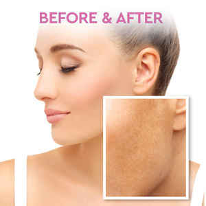 Marque privée Crème éclaircissante naturelle pour le visage Zones intimes sensibles Correcteur des taches brunes Crème hydratante éclaircissante pour la peau - Product Image 6