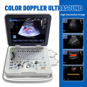 Appareil d'échographie Doppler couleur portable pour ordinateur portable, scanner de diagnostic médical avec <span class=keywords><strong>sonde</strong></span> convexe linéaire transvaginale - Product Image 3