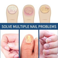 EELHOE Patchs Naturels de Renouvellement des Ongles pour la Décoloration – Soutien Herbal Transdermique pour Ongles Épais et Bien-être – 32 Patchs