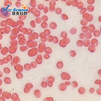 Hematology Prepared Slides Blood Smear Microscope Slide Handmade From Glass
