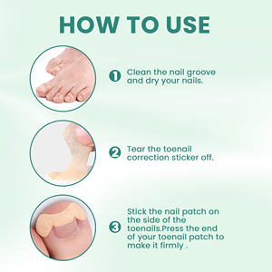 Pegatinas de corrección de uñas para prevenir hierbas baratas de fábrica con efecto de larga duración, yeso chino - Product Image 5