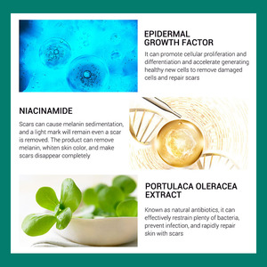 <span class=keywords><strong>BREYLEE</strong></span> Marca Reduce Visiblemente Cicatrices Eliminación de Acné Crema de Estrías Profundas Adultos Herbal Crema de eliminación de cicatrices de acné femenino SS - Product Image 6