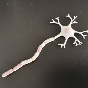 Medicina Humana, Complicaciones <span class=keywords><strong>de</strong></span> la Diabetes, Ojos, Corazón, Riñones, Vasos Sanguíneos, Pie, Cirugía Interna y Externa, Rehabilitación, Patología - Product Image 5