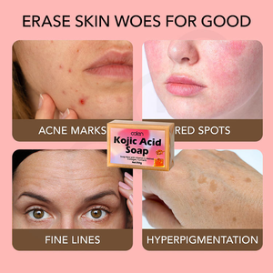 <span class=keywords><strong>Savon</strong></span> à l'acide kojique Luxfume 150g <span class=keywords><strong>Savon</strong></span> artisanal blanchissant exfoliant Lisse la rugosité Éclaircit le teint - Product Image 6