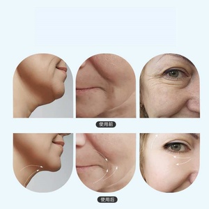 Appareil de massage beauté pour le raffermissement et le rajeunissement de la peau, appareil facial à microcourant pour le raffermissement de la peau, blanc - Product Image 5