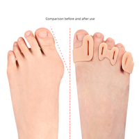 Séparateur d'orteils, correcteur d'hallux valgus, orthèse en gel de silicone, redresseur, espaceur, attelle, soulagement de la douleur, pour hommes et femmes