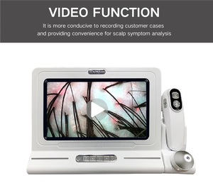 Analizador de Cuero Cabelludo Portátil Meicet, Inalámbrico, con WiFi, Luz LED, Detector de Folículos para Análisis Capilar, con IA Disponible, UE - Product Image 4