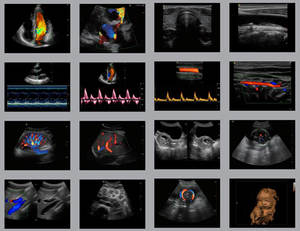 Draagbare 3D 4D Kleur Doppler Usg & Sonoscape S9 - Product Image 5