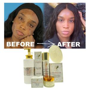 发光护肤常规清除瑕疵色素沉着过度紧致漂白美白护肤套装 - Product Image 1