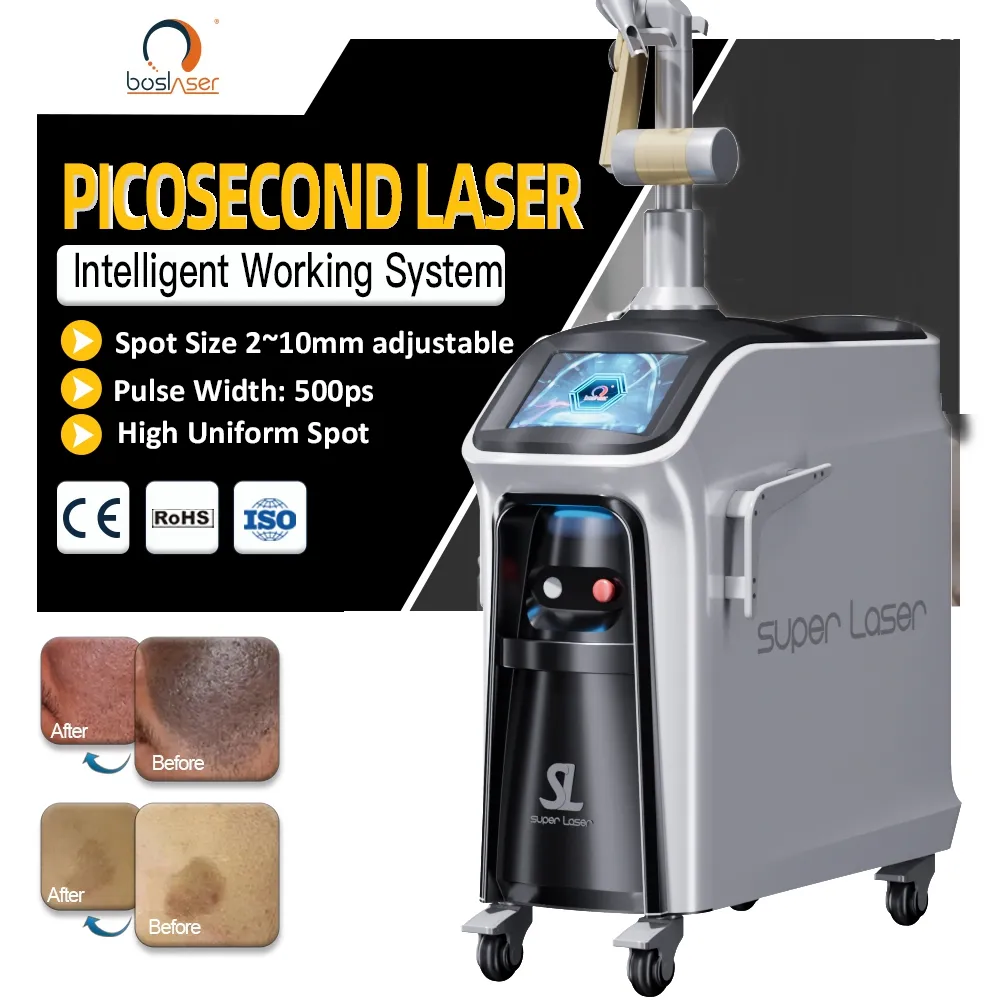 Mesin laser penghilang tato, model terbaru 2023 New ST laser picosecond picosecond q-switch