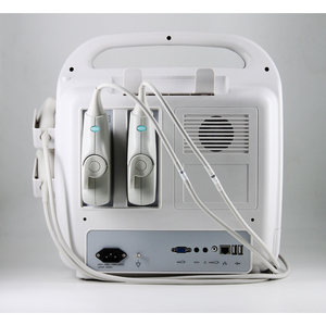 Échographe Doppler Couleur Vétérinaire VS-P50 Haute <span class=keywords><strong>Définition</strong></span> Numérique pour Bétail d'Élevage et Animaux de Compagnie - Product Image 6