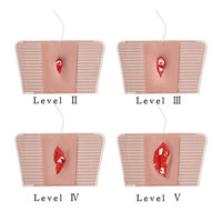 Modèles de fractures orthopédiques en silicone portables pour l'enseignement médical DARHMMY (Différents niveaux de gravité)
