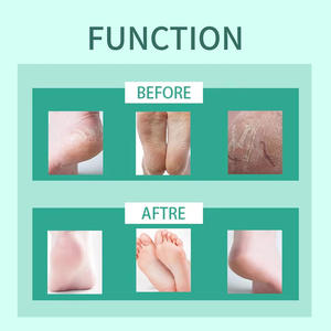 Icesea Best Selling Moisturising Collagen Magic Foot Peel  Private Label Beauty Exfoliating Foot  OEM/ODM - Product Image 4