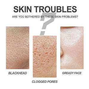 2025 <b>Nose</b> Plaster Customized Anti Snoring Patch Strength Breath Right Nasal <b>Strips</b> Nosestripes <b>for</b> Sleeping Manufacturer - Product Image 6