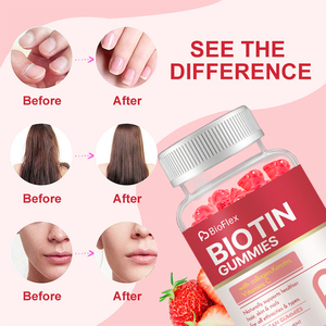 Gomitas de Keratina con Biotina y Colágeno para Crecimiento del Cabello y Blanqueamiento de la Piel, Suplemento Vitamínico de Marca Privada para Cabello, Piel y Uñas - Product Image 4