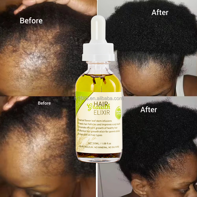 Private Label 100 Natural Organic Scalp