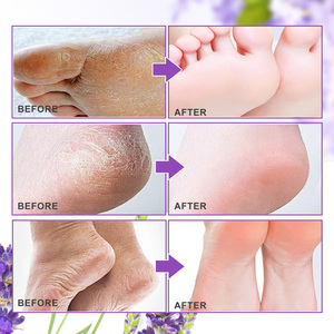 ALIVER <span class=keywords><strong>Masque</strong></span> pour les pieds à la lavande, soin naturel à base de plantes pour la peau des pieds, hydratant, <span class=keywords><strong>exfoliant</strong></span>, peeling - Product Image 3