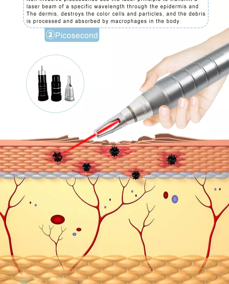 Portable 808 Diode Laser Hair Removal Machine picosecond laser remove freckles Pico laser Tattoo Removal Carbon peeling Device