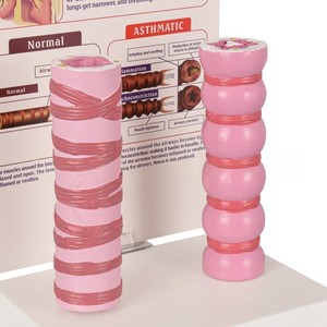 Medizinisches Lehrmodell: Vergleich von Normaler und Asthmatischer Luftröhre für Atemwegsunterricht - Product Image 2